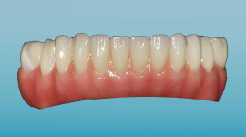 Dental Lab Materials